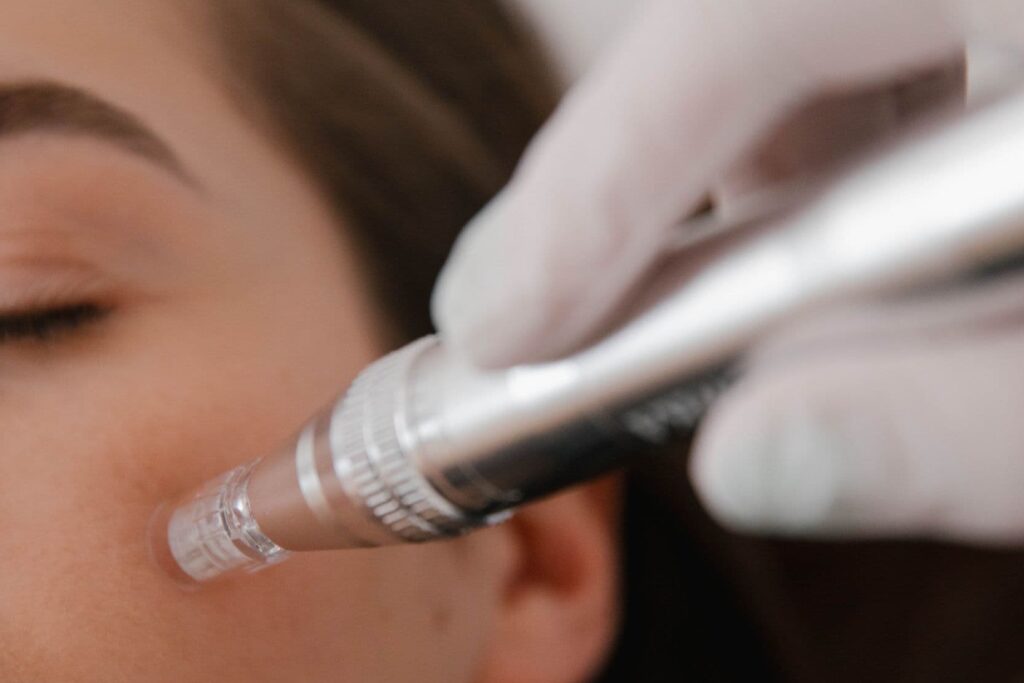 service-microneedling